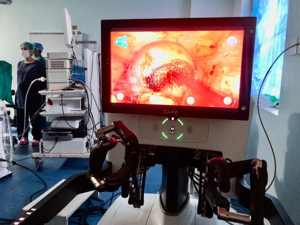 Robotic Ovarian Tumor